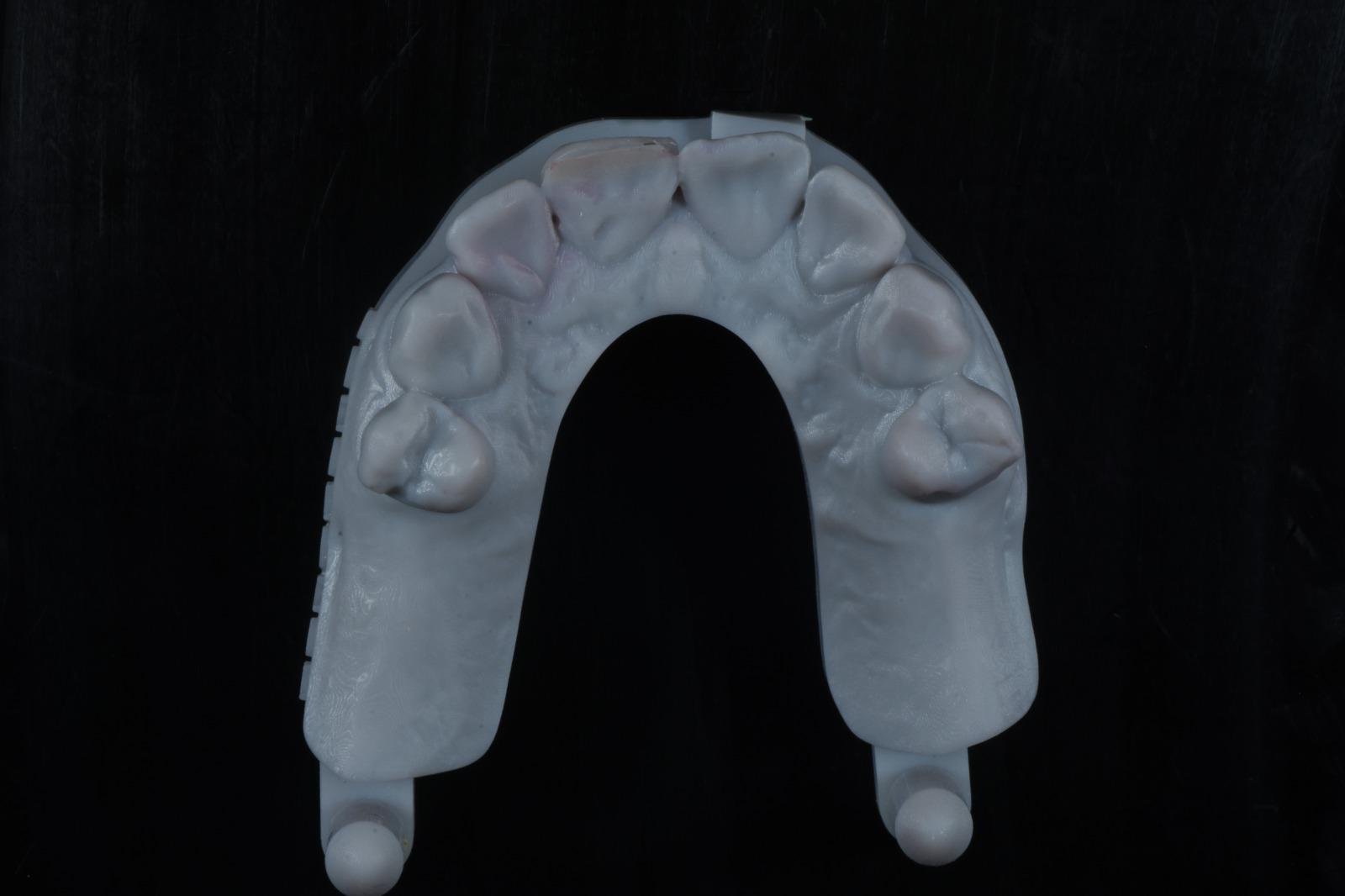 Vue occlusale complète